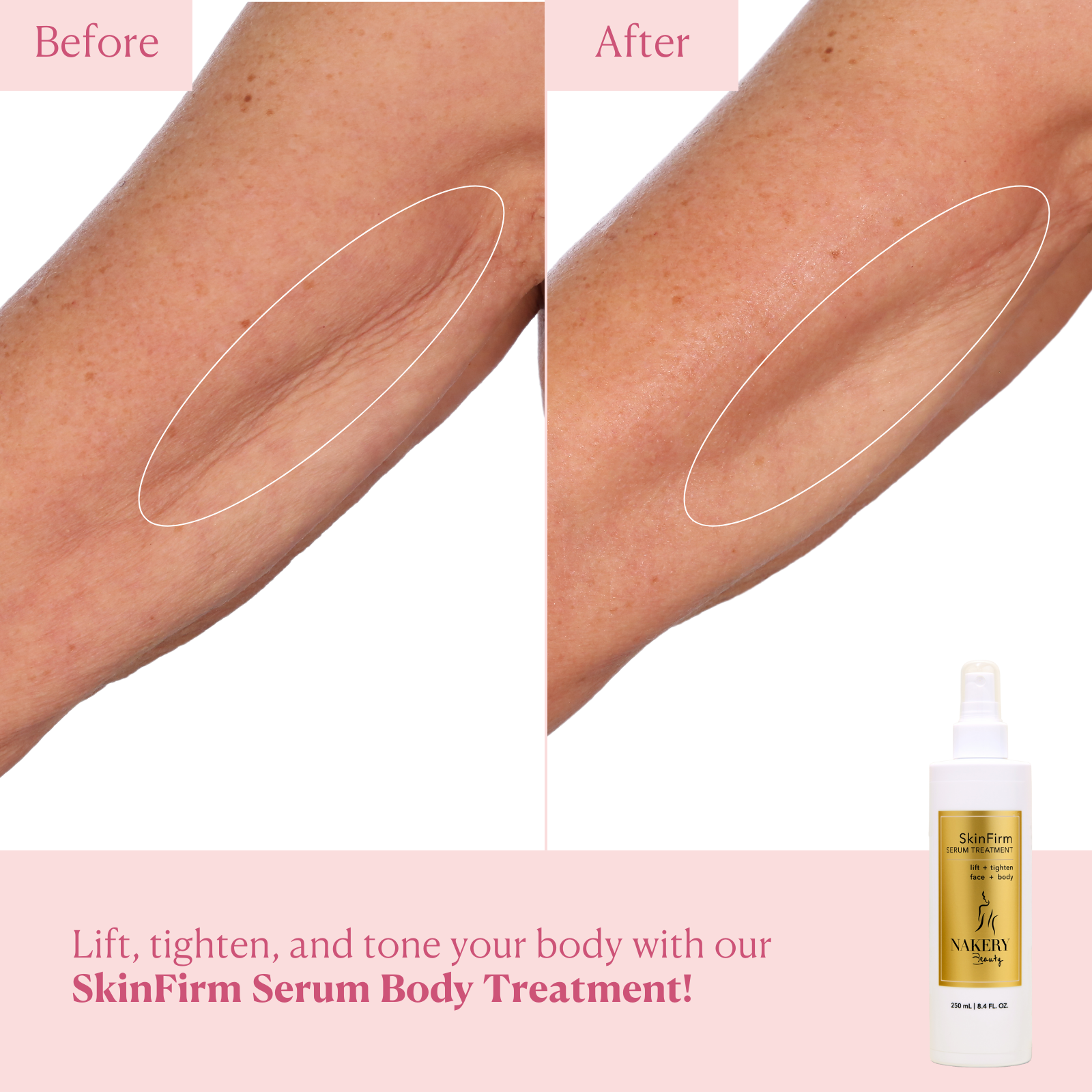 SkinFirm Serum Body Treatment