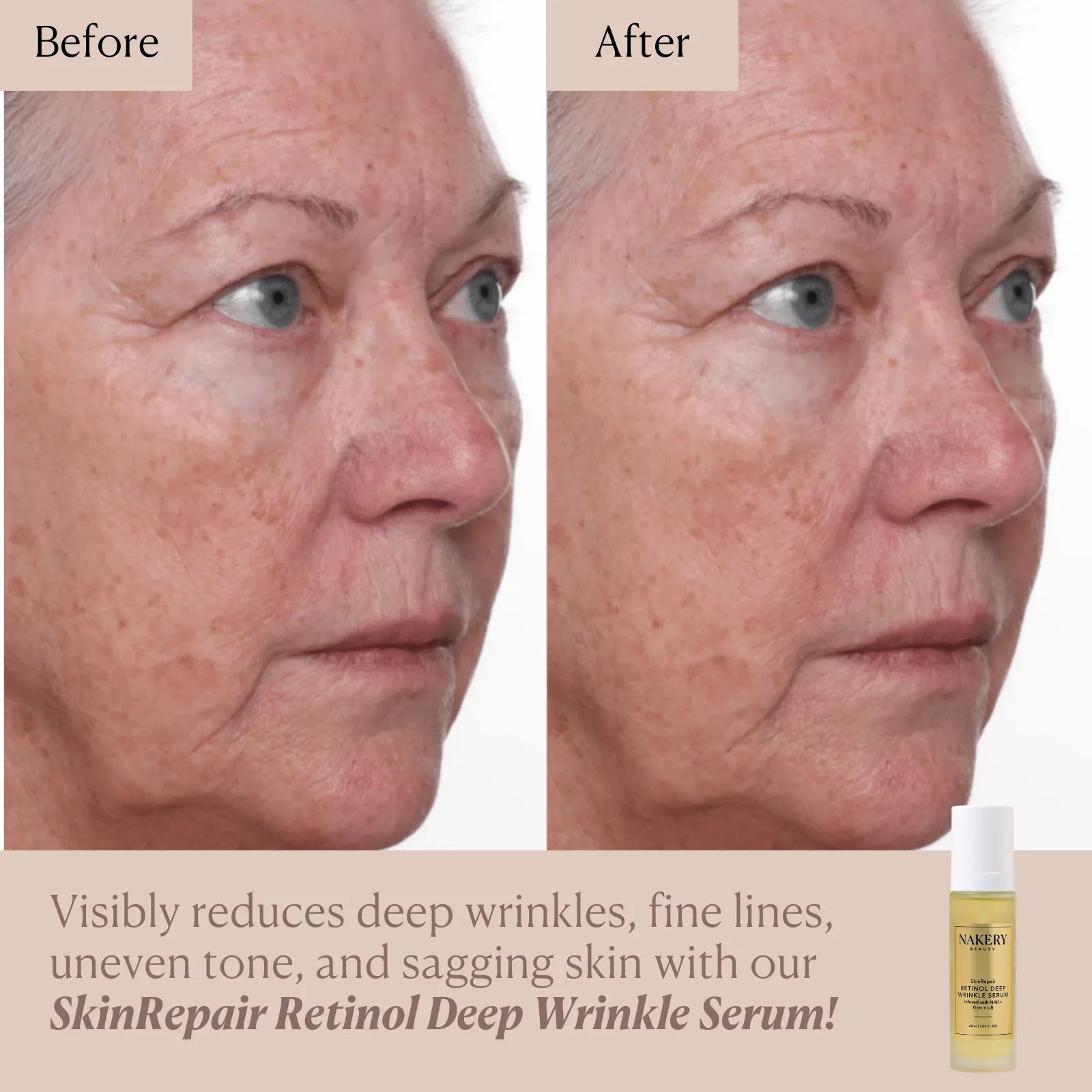 SkinRepair Retinol Deep Wrinkle Serum