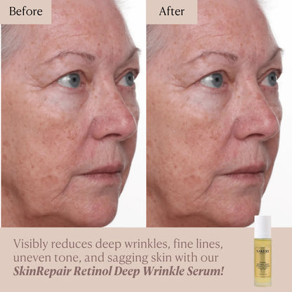 SkinRepair Retinol Deep Wrinkle Serum
