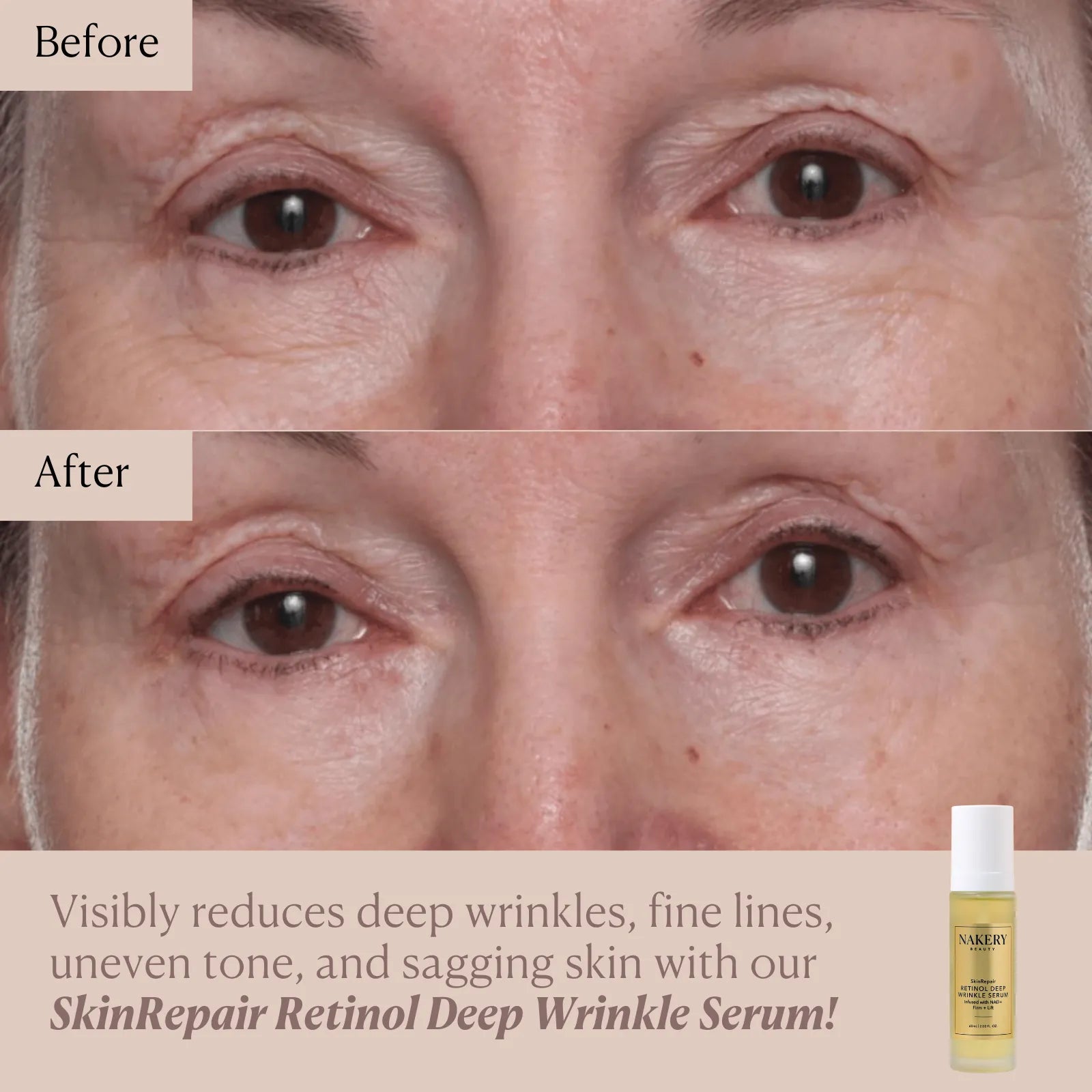 SkinRepair Retinol Deep Wrinkle Serum
