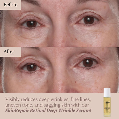 SkinRepair Retinol Deep Wrinkle Serum