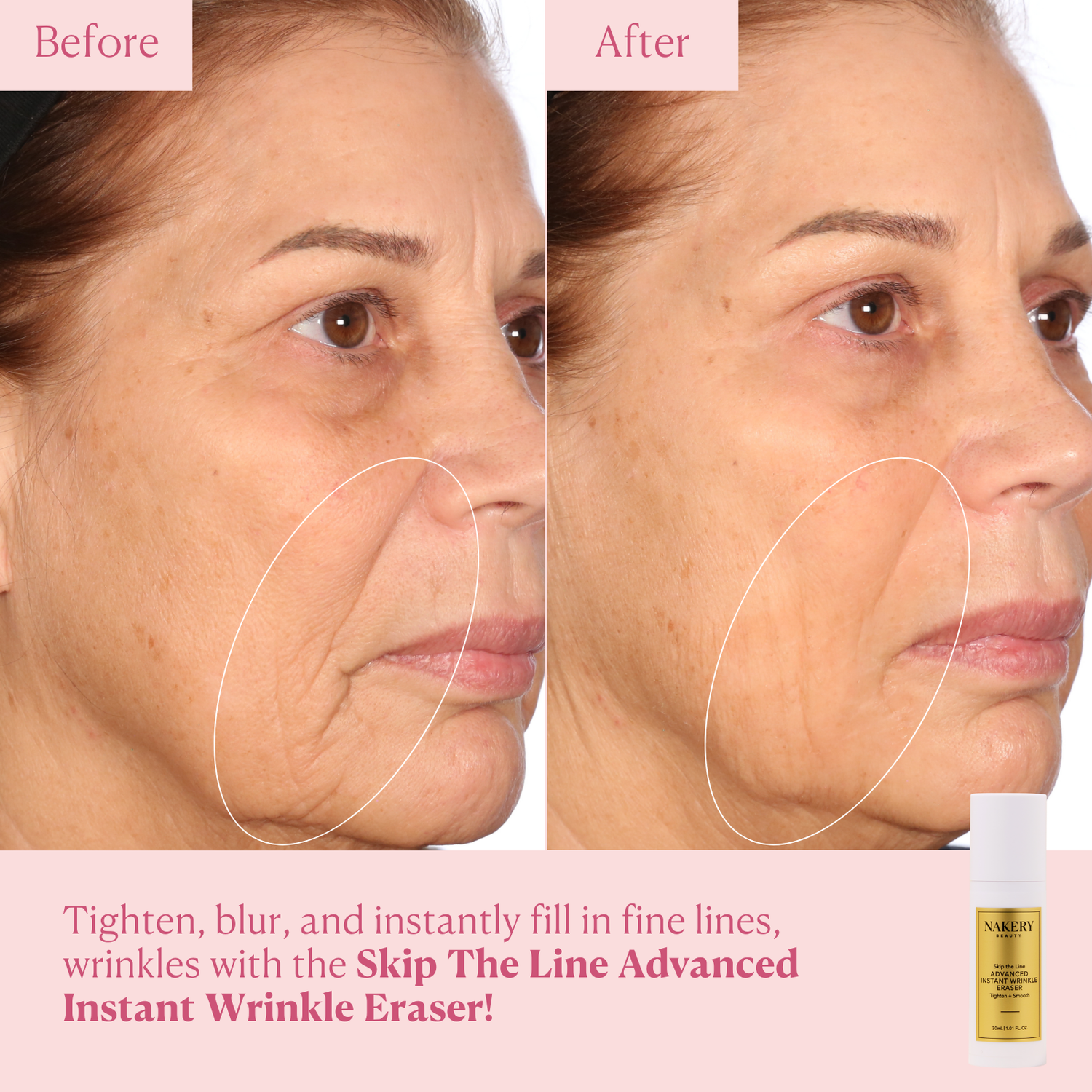 Skip the Line Advanced Wrinkle Eraser