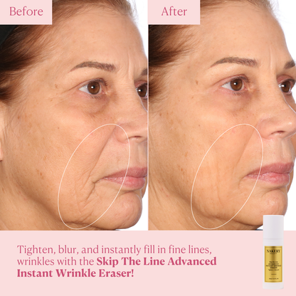 Skip the Line Advanced Wrinkle Eraser