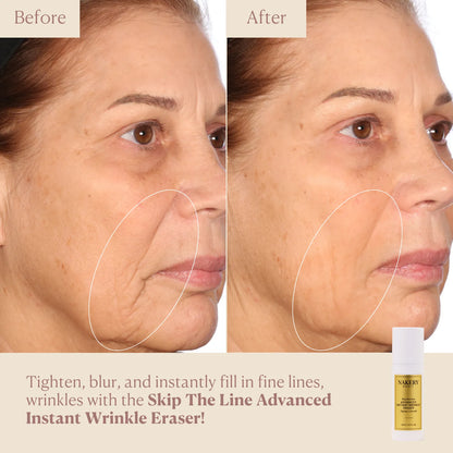 Skip the line-advanced instant wrinkle eraser before and after