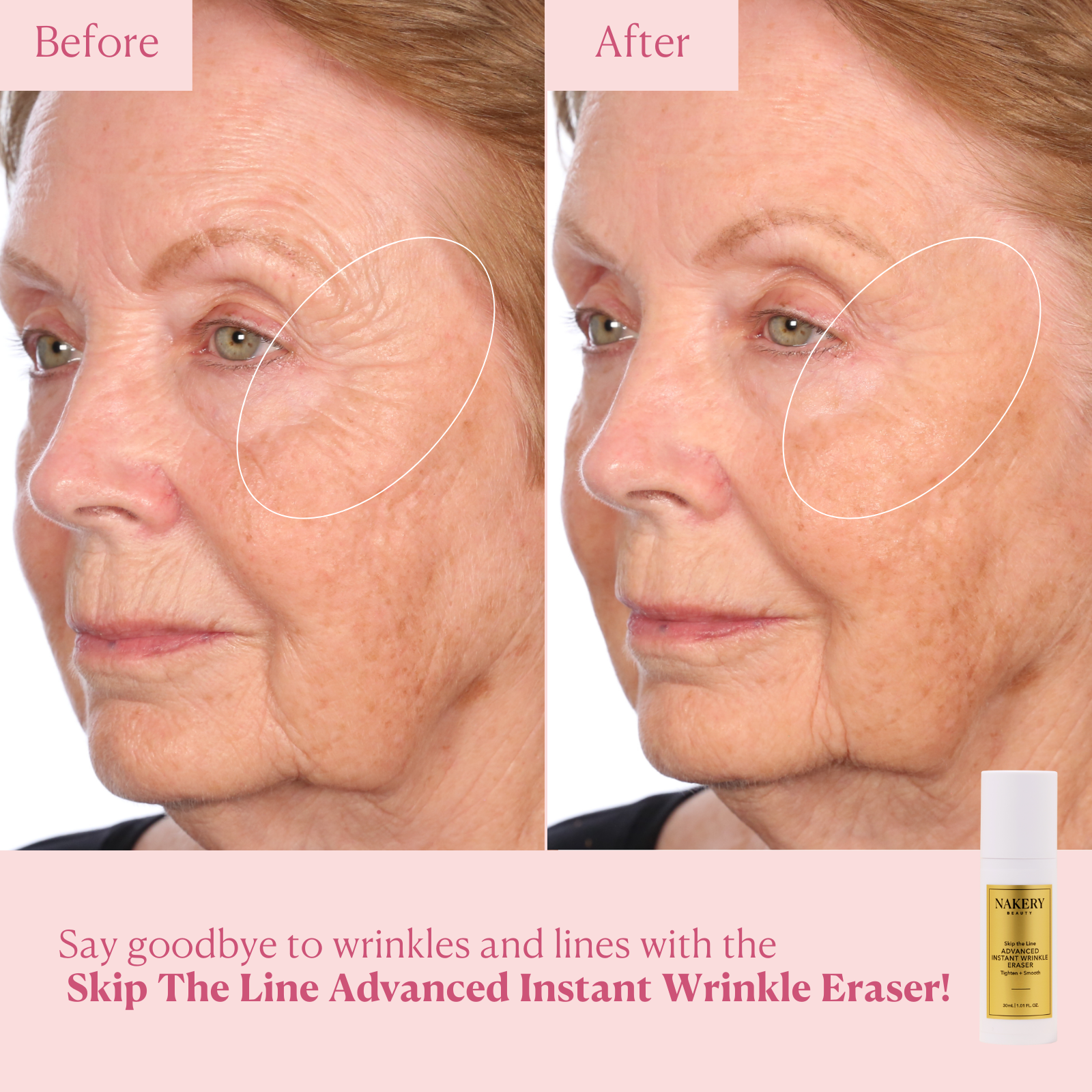 Skip the Line Advanced Wrinkle Eraser