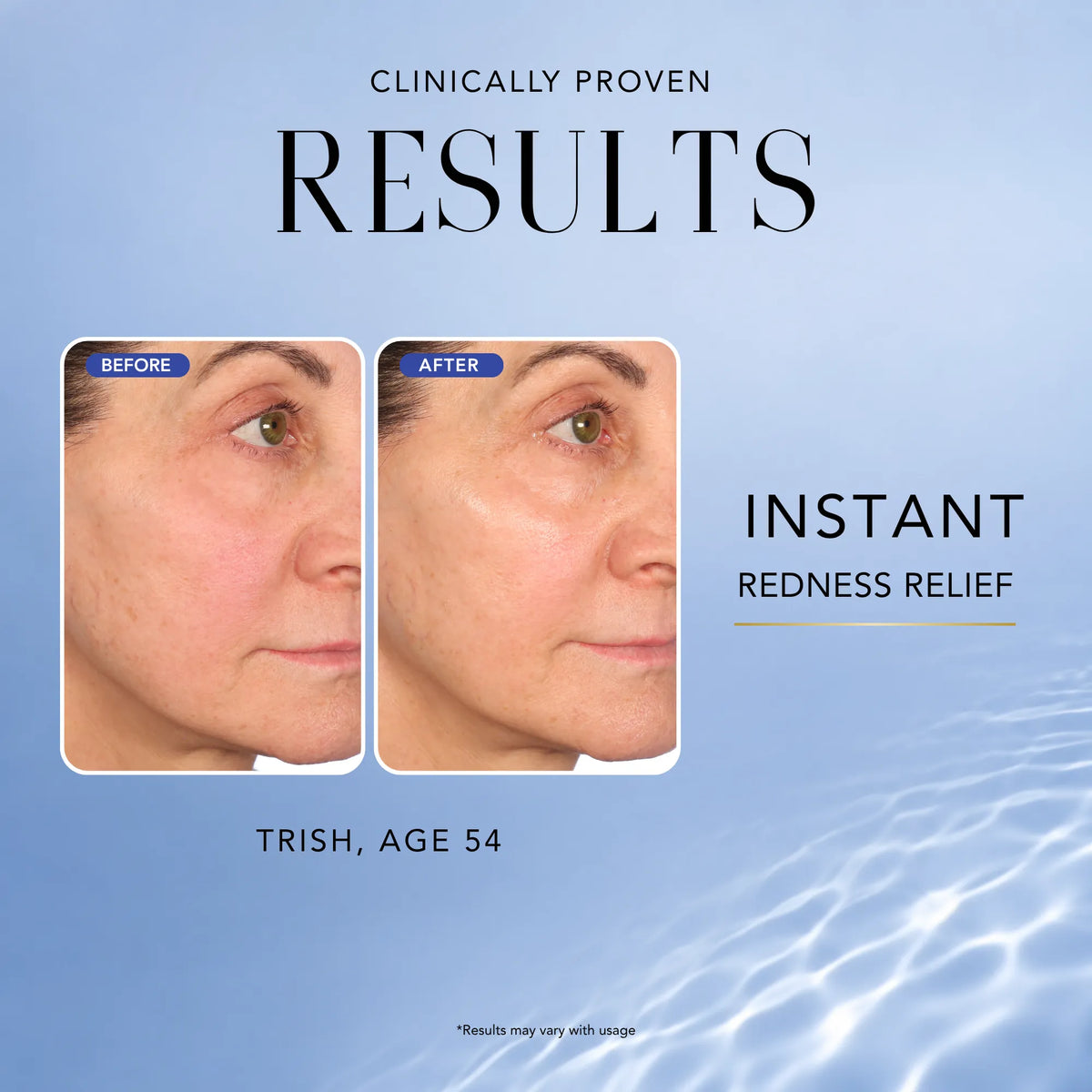 Before-and-after comparison showing reduced facial redness after using Nakery Beauty Universal Clarifying Spray.