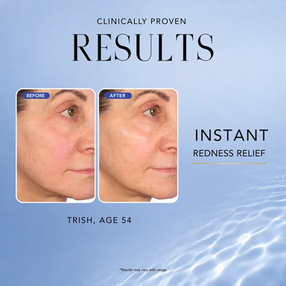 Before-and-after comparison showing reduced facial redness after using Nakery Beauty Universal Clarifying Spray.