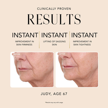 Before-and-after comparison of Judy, age 67, showing clinically proven instant improvement in skin firmness, lifting of sagging skin, and skin tightness.
