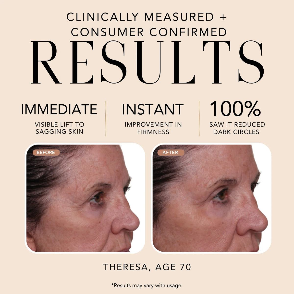 Before-and-after comparison of Theresa, age 70, showing visible improvement in eye-area firmness, sagging skin, and dark circles after using Nakery Beauty Lift-TOX Anti-Gravity Eye Cream.