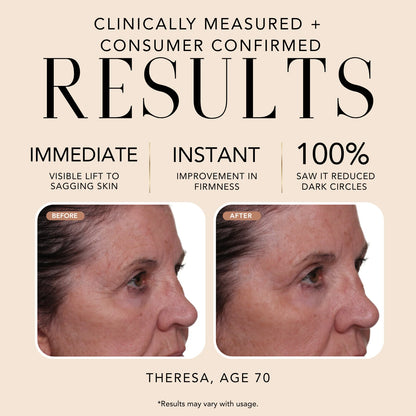 Before-and-after comparison of Theresa, age 70, showing visible improvement in eye-area firmness, sagging skin, and dark circles after using Nakery Beauty Lift-TOX Anti-Gravity Eye Cream.