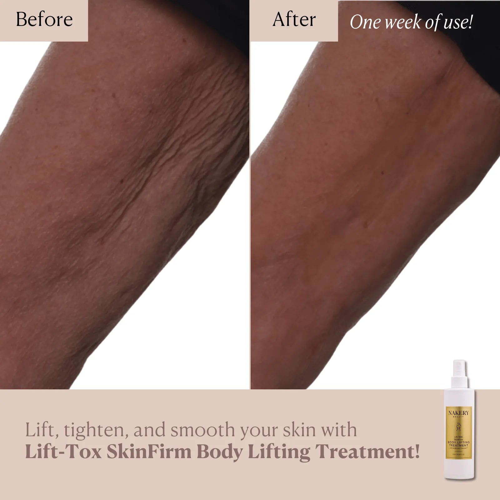 Lift-TOX SkinFirm Body Lifting Treatment - Nakery Beauty