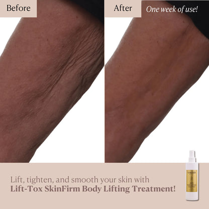 Lift-TOX SkinFirm Body Lifting Treatment - Nakery Beauty