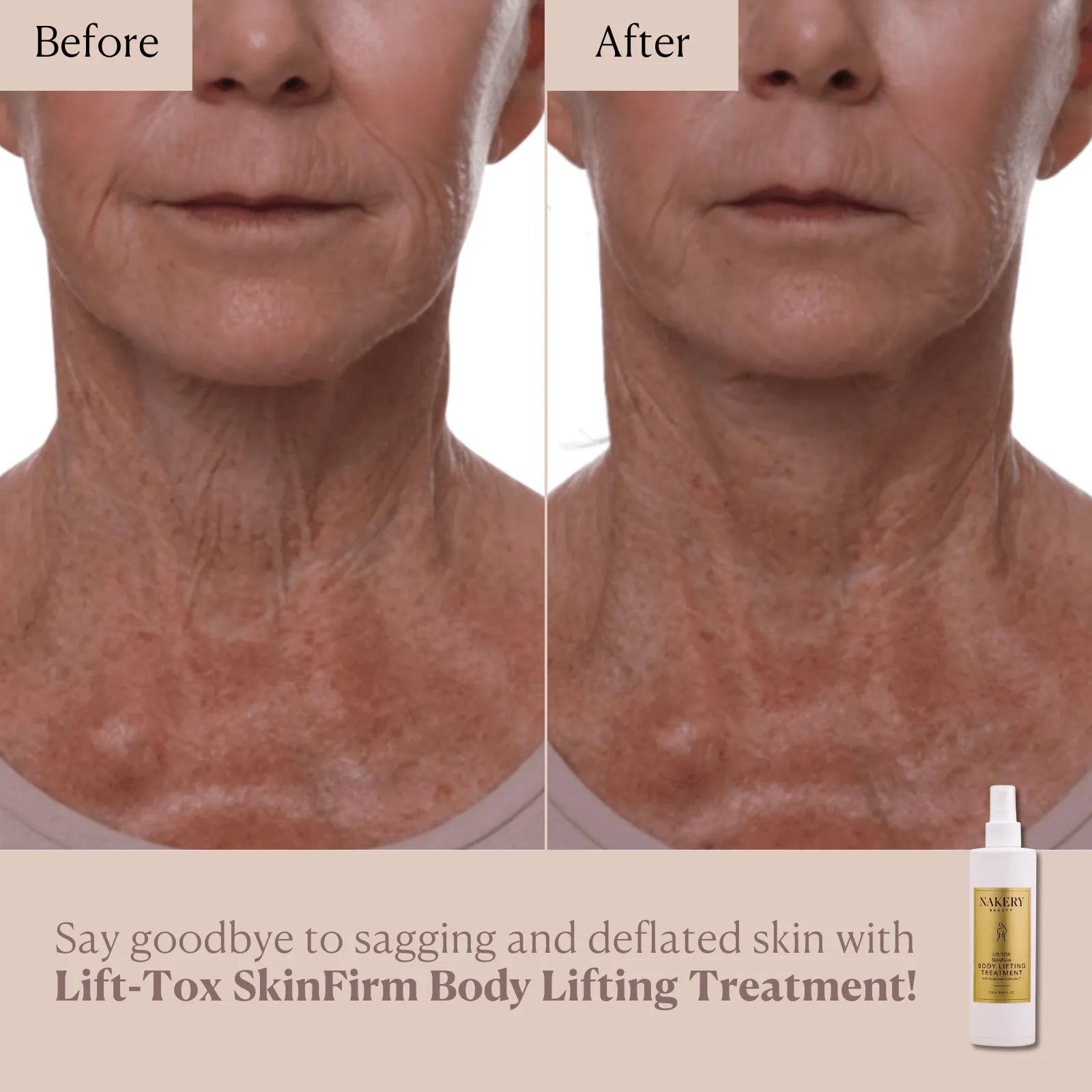 Lift-TOX SkinFirm Body Lifting Treatment - Nakery Beauty