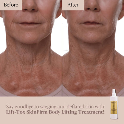Lift-TOX SkinFirm Body Lifting Treatment - Nakery Beauty