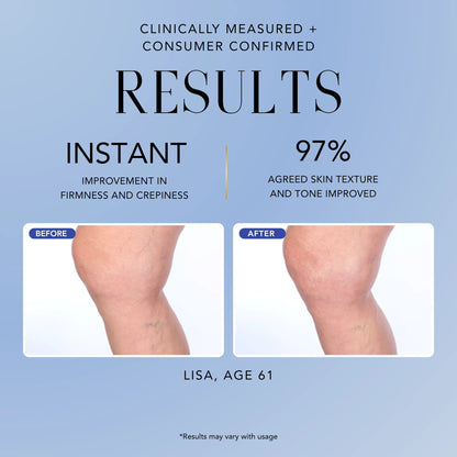 Before-and-after results for Nakery Make It Vanish Power Cream showing improved skin firmness, crepiness, texture, and tone.