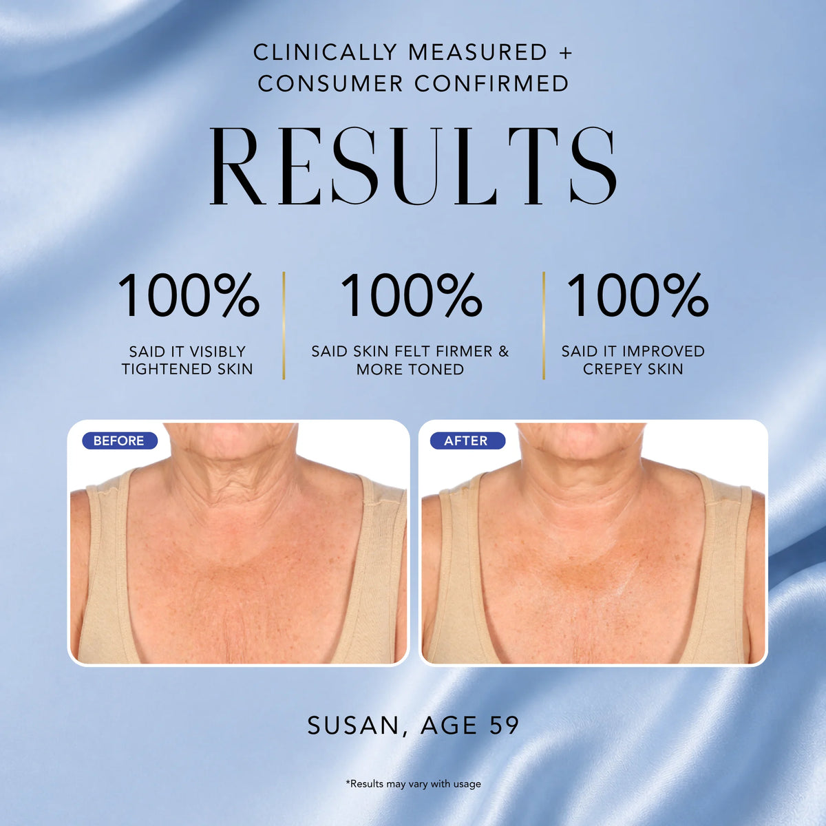 Before-and-after neck and chest comparison showing results from Nakery Beauty Relax + Repair Body Balm, with firmer, more toned and smoother-looking skin.