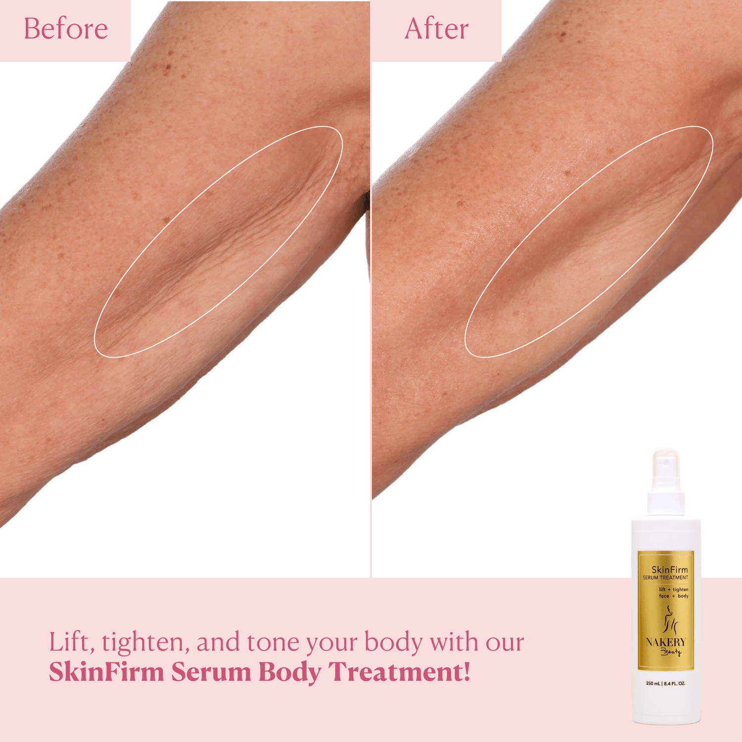 SkinFirm Serum Body Treatment - Nakery Beauty