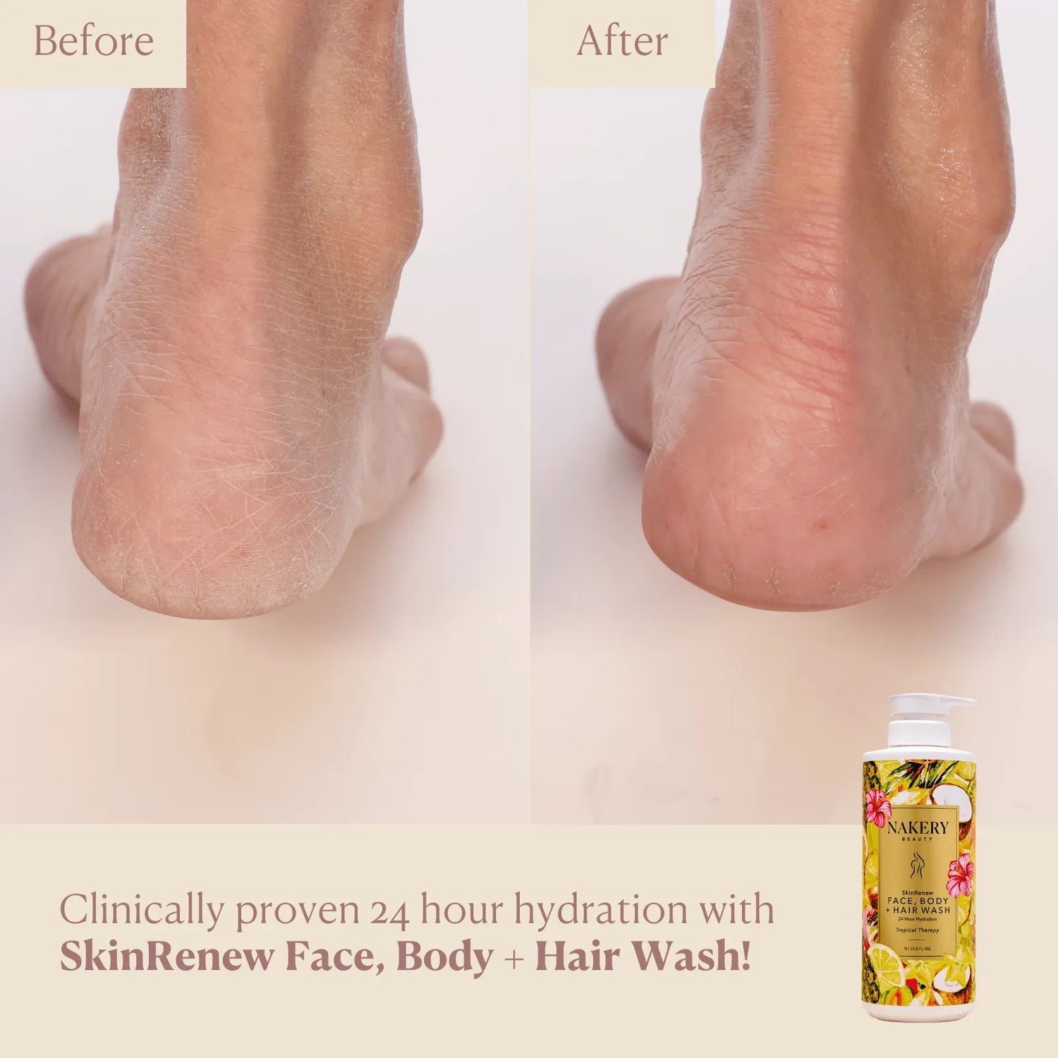 SkinRenew Face, Body + Hair Wash