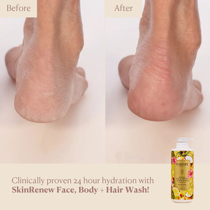 SkinRenew Face, Body + Hair Wash