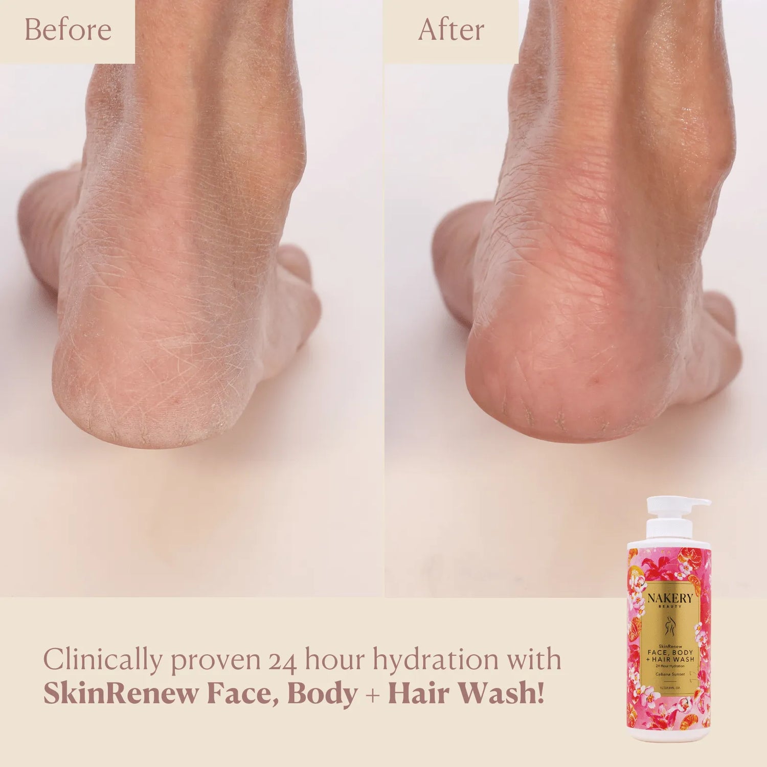 SkinRenew Face, Body + Hair Wash