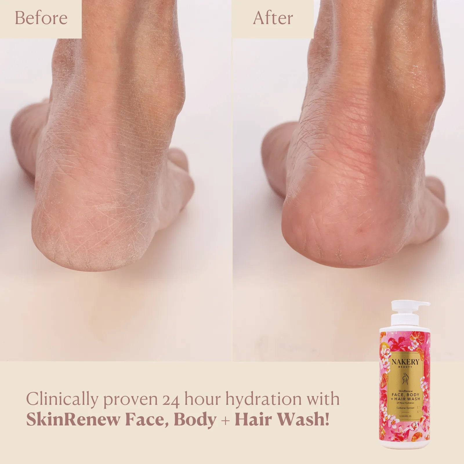 SkinRenew Face, Body + Hair Wash