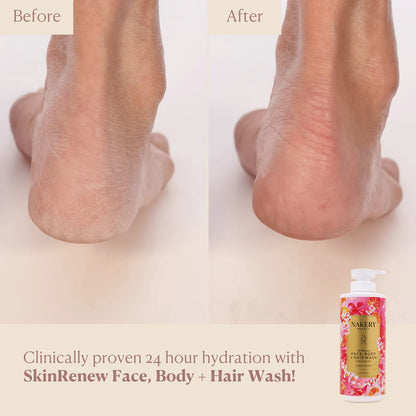 SkinRenew Face, Body + Hair Wash