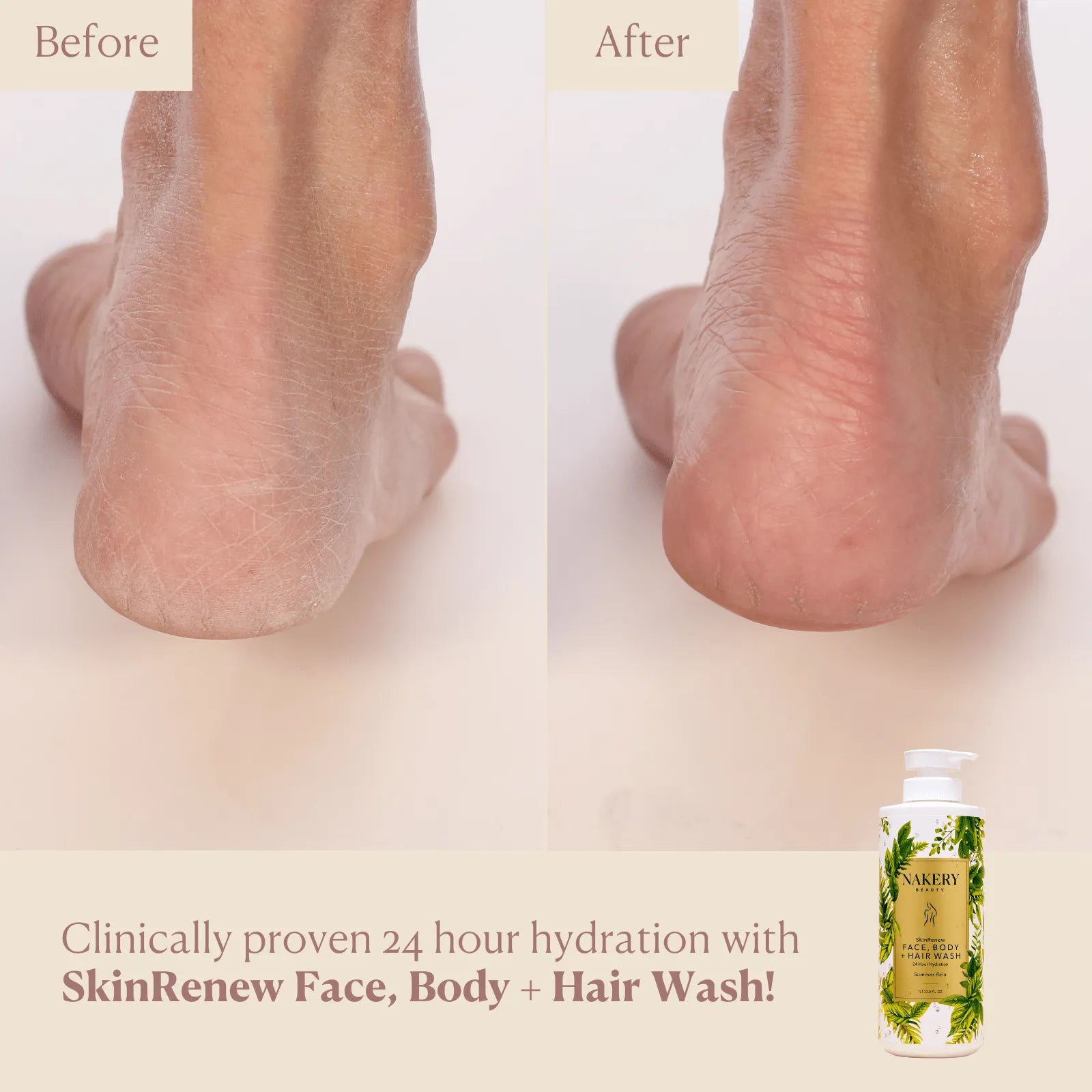 SkinRenew Face, Body + Hair Wash