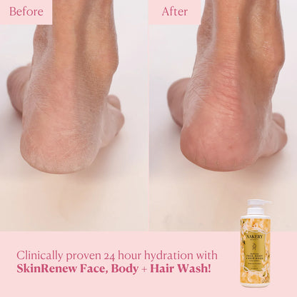 SkinRenew Face, Body + Hair Wash