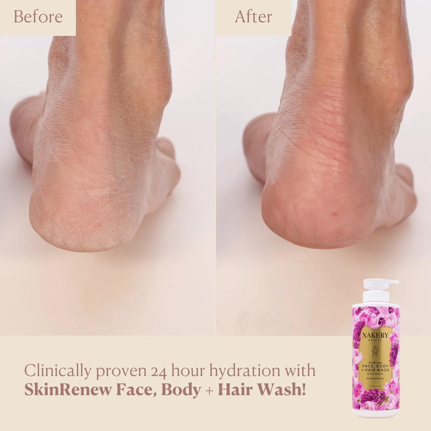 SkinRenew Face, Body + Hair Wash