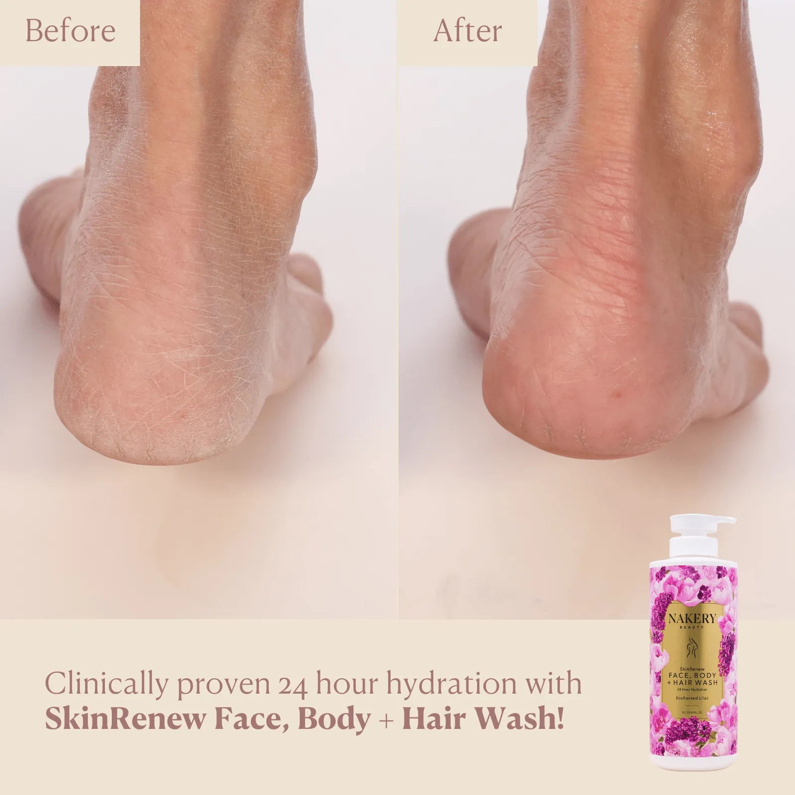 SkinRenew Face, Body + Hair Wash