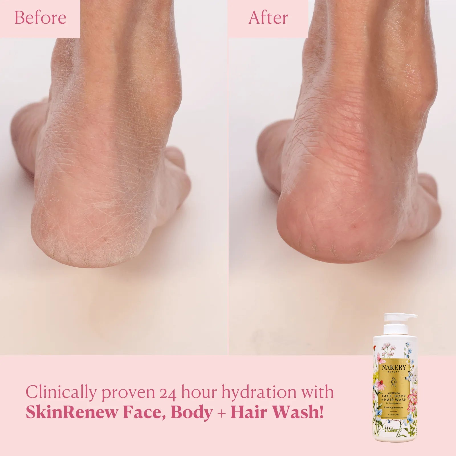 SkinRenew Face, Body + Hair Wash