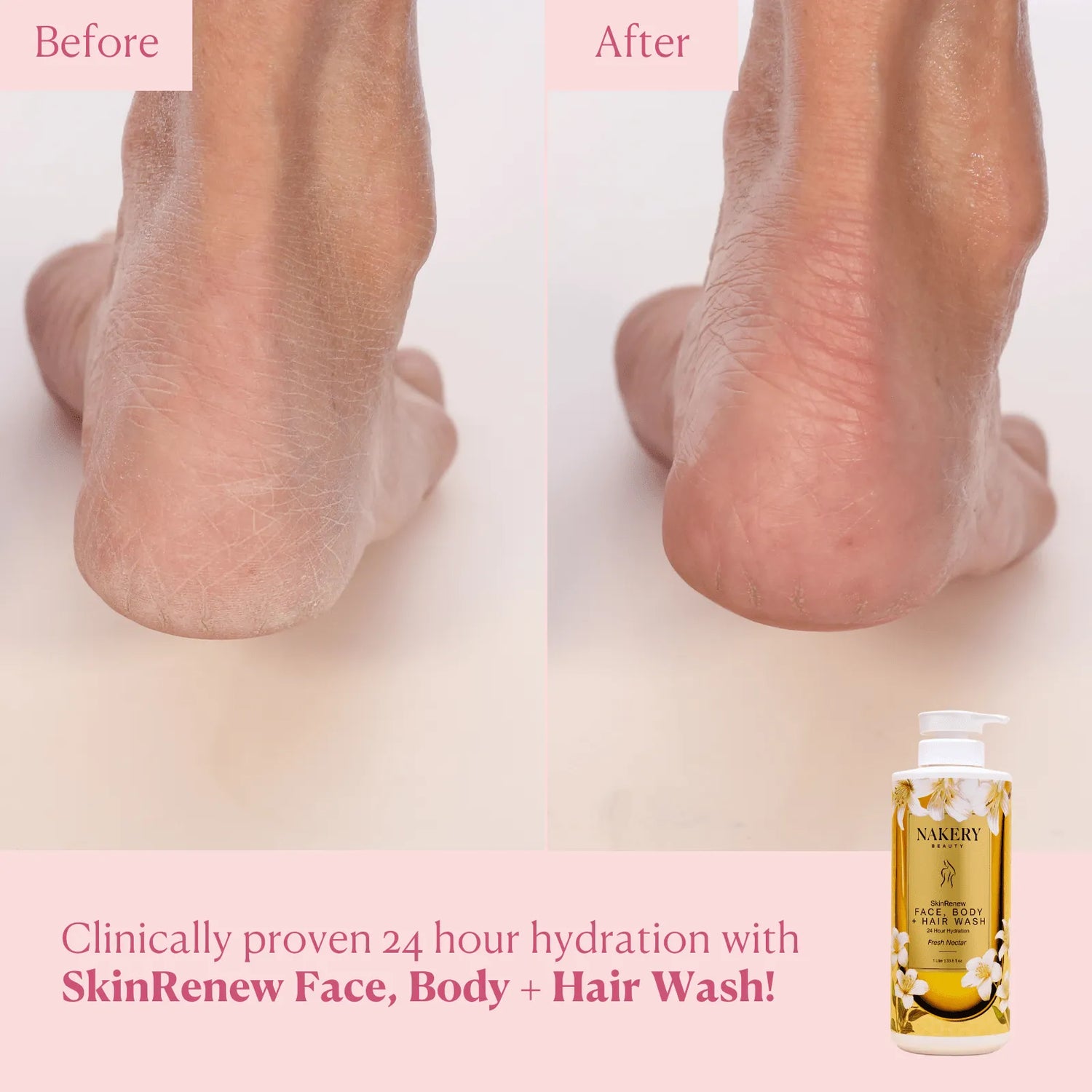 SkinRenew Face, Body + Hair Wash