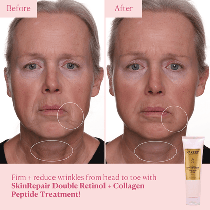 SkinRepair Double Retinol + Collagen Face &amp; Body Treatment - Nakery Beauty