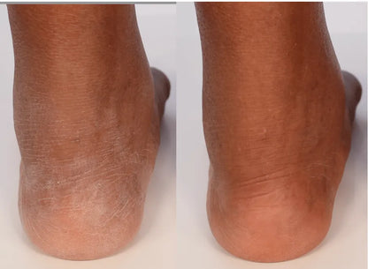 SkinRestore Body + Hand Wash - California Dreamin&