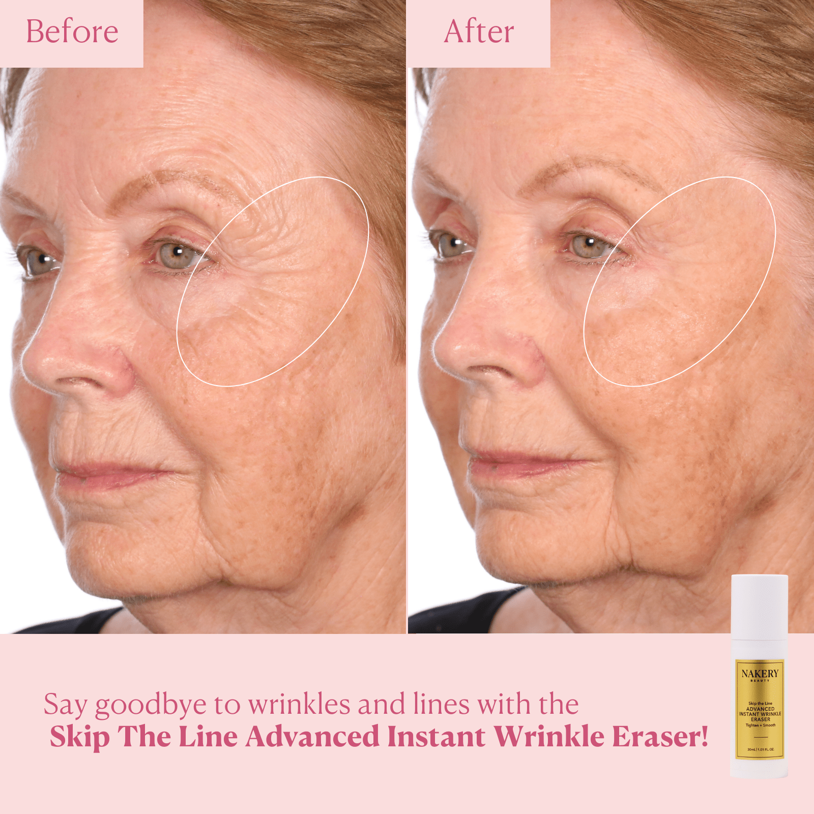 Skip the Line Advanced Wrinkle Eraser - Nakery Beauty